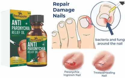 Anti Paronychia Relief Oil – Pack of 2 (20 ml Each)